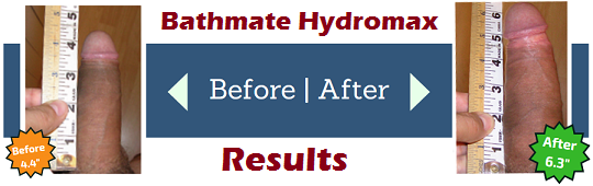 bathmate before and after results after 1 year